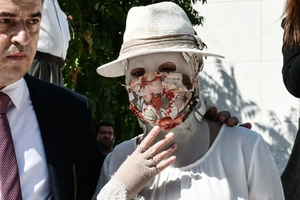 Η εξομολόγηση της γυμνάστριας της Ιωάννας Παλιοσπύρου – Η φωτογραφία από τα παλιά και οι δυσκολίες