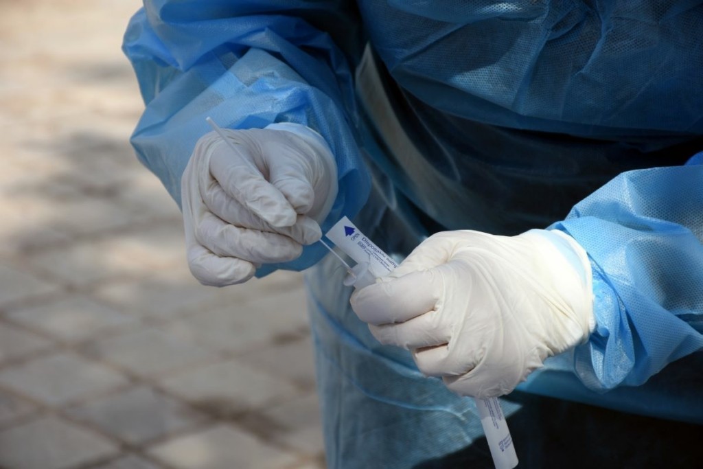 3.065 νέα κρούσματα για την Τρίτη – Πόσοι διασωληνωμένοι και θάνατοι ανακοινώθηκαν