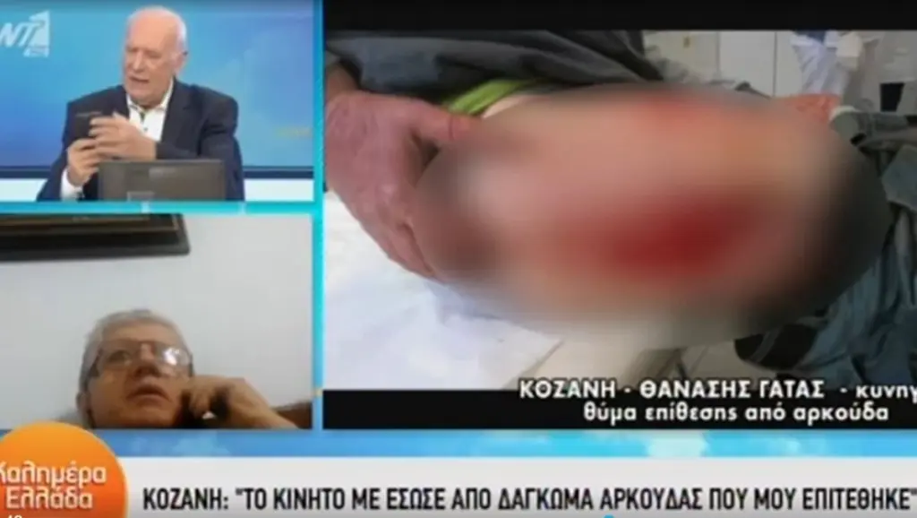 Απίστευτη μαρτυρία κυνηγού που δέχτηκε επίθεση από αρκούδα στην Κοζάνη – Τον έσωσε το… κινητό του (vid)