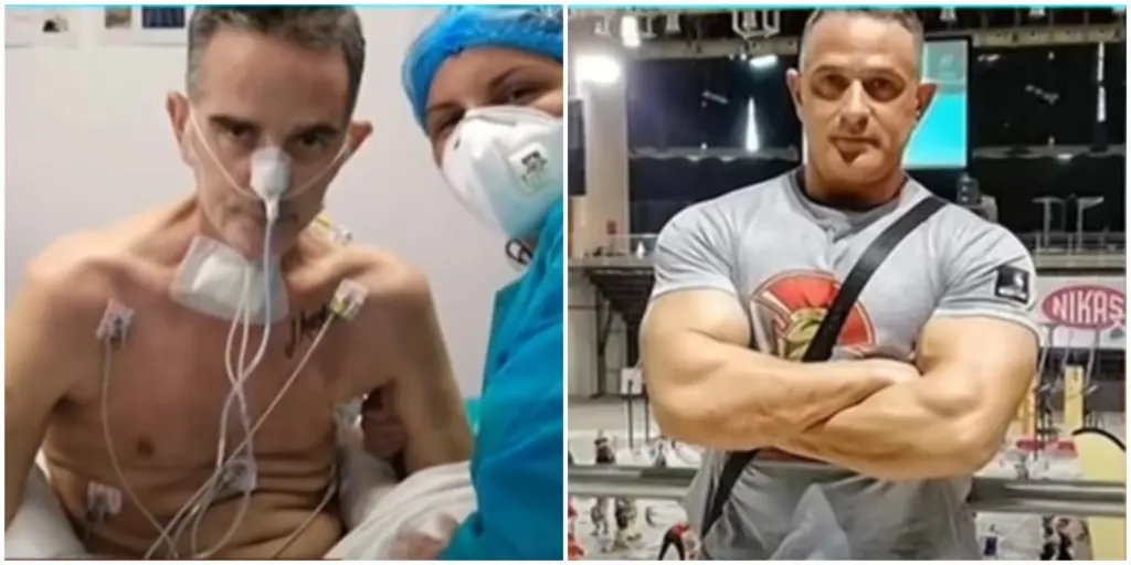 Οι τρομακτικές επιπτώσεις του κορονοϊού – Αθλητής body building έχασε 42 κιλά μέσα σε δυο μήνες στη ΜΕΘ