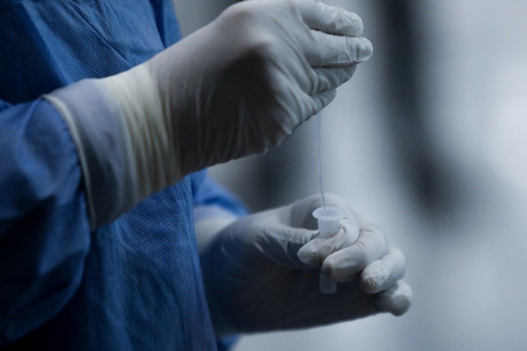 Ενστάσεις για τα rapid test σε εμβολιασμένους από τον Εξαδάκτυλο (vid)