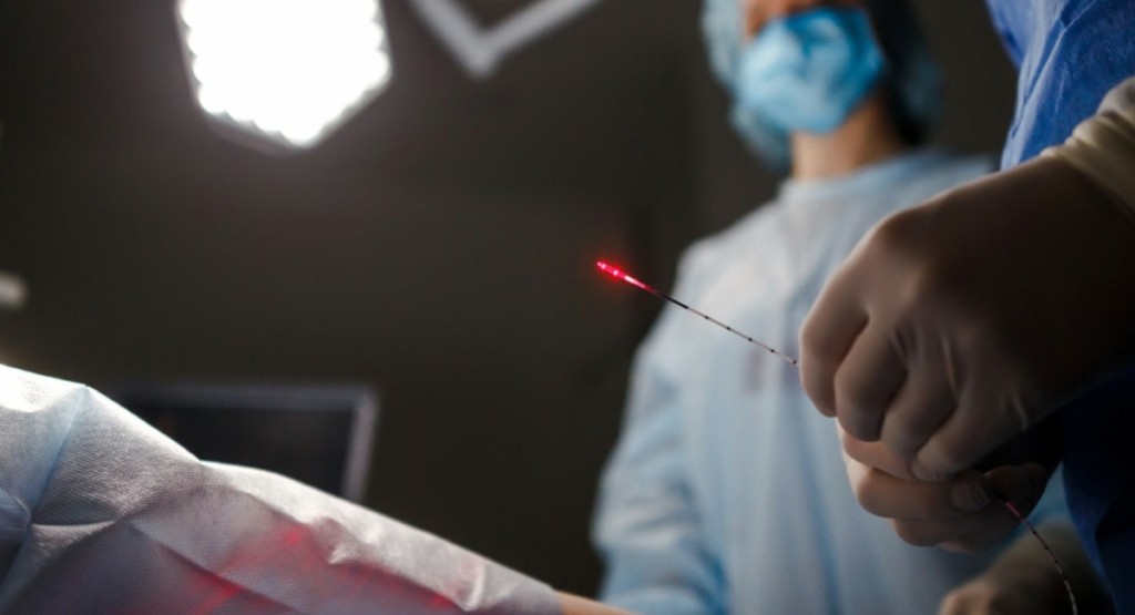 Το ενδοαυλικό Laser είναι το νέο όπλο κατά της φλεβικής ανεπάρκειας και των κιρσών