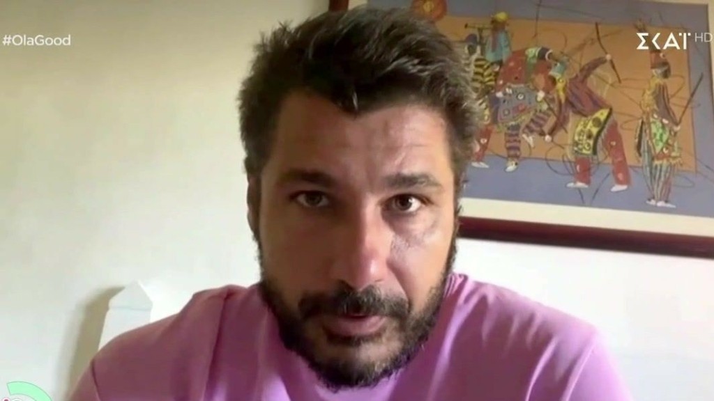 “Θέλω να ξεχάσω ότι υπήρξε Βαλάντης στο Survivor” – Οι πρώτες δηλώσεις του Λάμπρου Κωνσταντάρα μετά την αποχώρησή του
