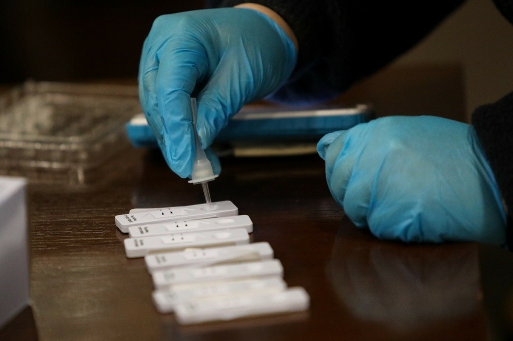 Πότε λήγει η προθεσμία για τις δηλώσεις των rapid test των εργοδοτών στο ΕΡΓΑΝΗ
