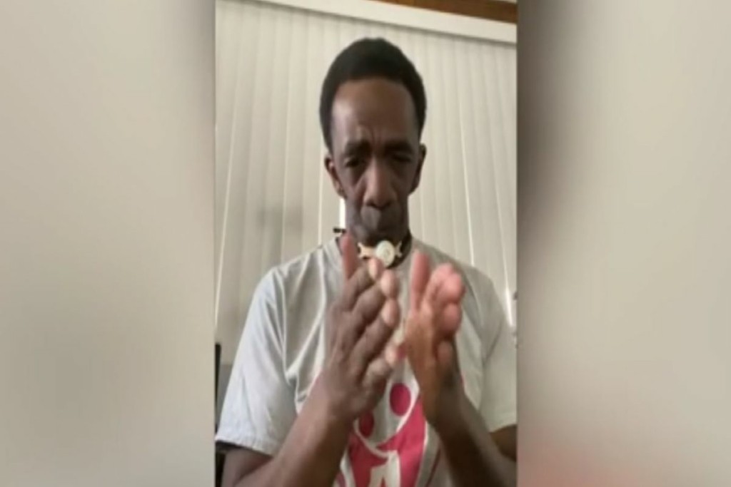 Γεννήθηκε χωρίς σαγόνι, βίωσε πολύ σκληρό bullying αλλά βρήκε τον έρωτα στα μάτια μιας πανέμορφης γυναίκας