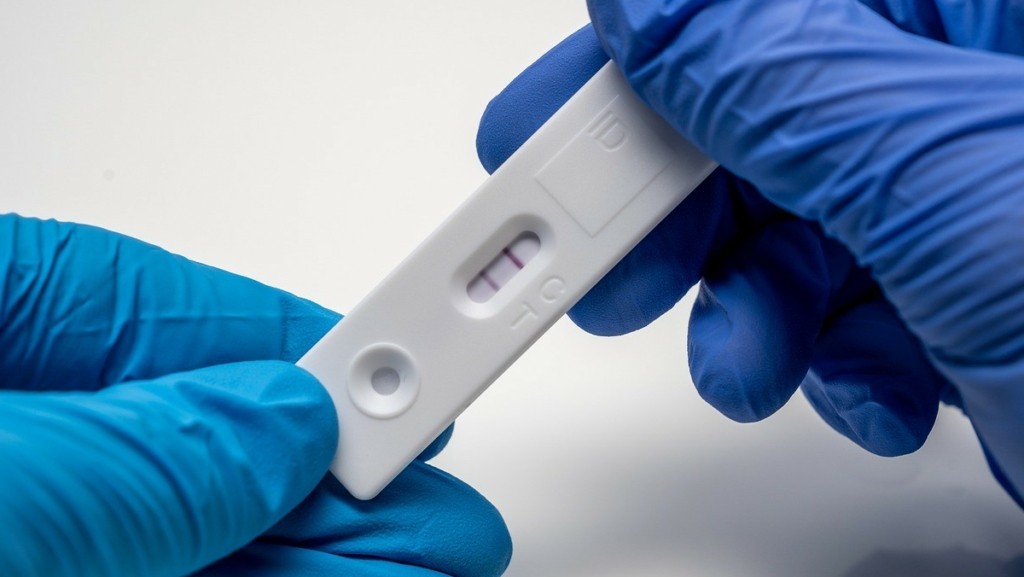 ΕΟΔΥ: Πάνω από 500 νέες εισαγωγές με Covid-19 την τελευταία εβδομάδα – 6 διασωληνώσεις και 14 θάνατοι