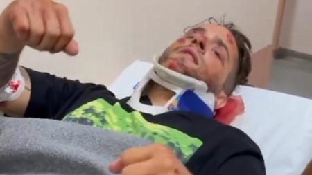 Στο νοσοκομείο ο γνωστός trapper iLLEOo – Είχε σοβαρό τροχαίο ατύχημα (vid)