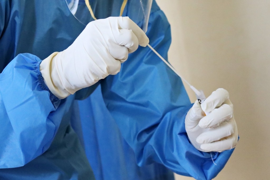 Στα 43.914 κρούσματα κορονοϊού την τελευταία εβδομάδα – 118 θάνατοι και 93 διασωληνωμένοι