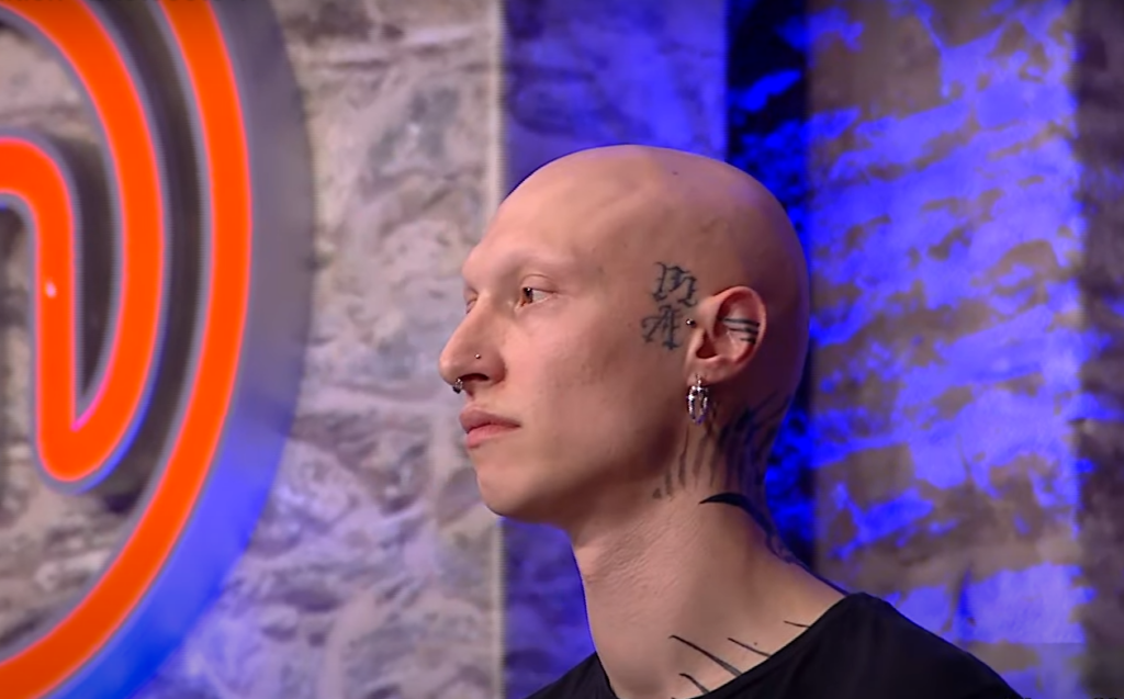 Κατάθεση ψυχής από διαγωνιζόμενο του MasterChef με την αλωπεκία – “Ξύπνησα και μου είχαν πέσει τα μισά μαλλιά” (vid)