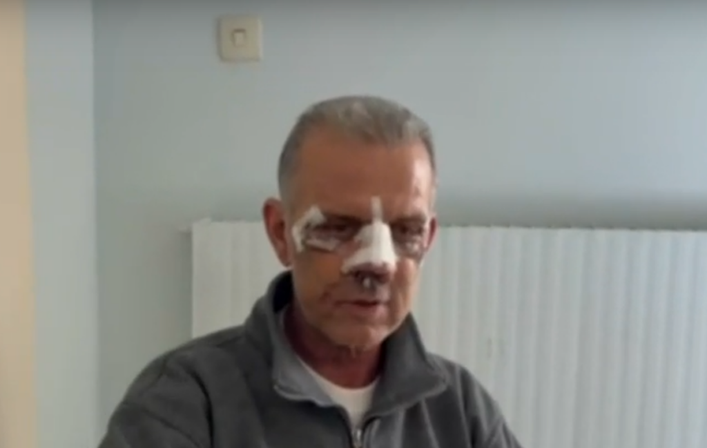 Απίστευτος ξυλοδαρμός στο Περιστέρι – Τον έστειλε στο  νοσοκομείο την παραμονή της Πρωτοχρονιάς για μια παρατήρηση! (vid)