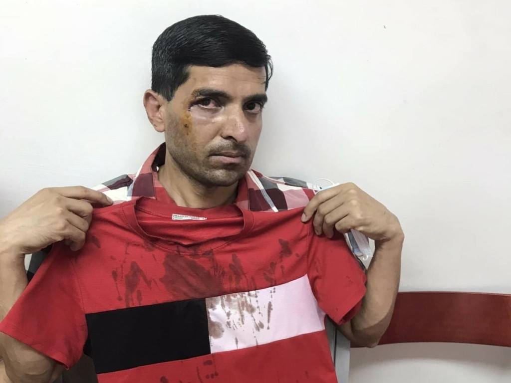 Σοβαρές καταγγελίες για ξυλοδαρμούς σε βάρος μεταναστών από την ΚΕΕΡΦΑ