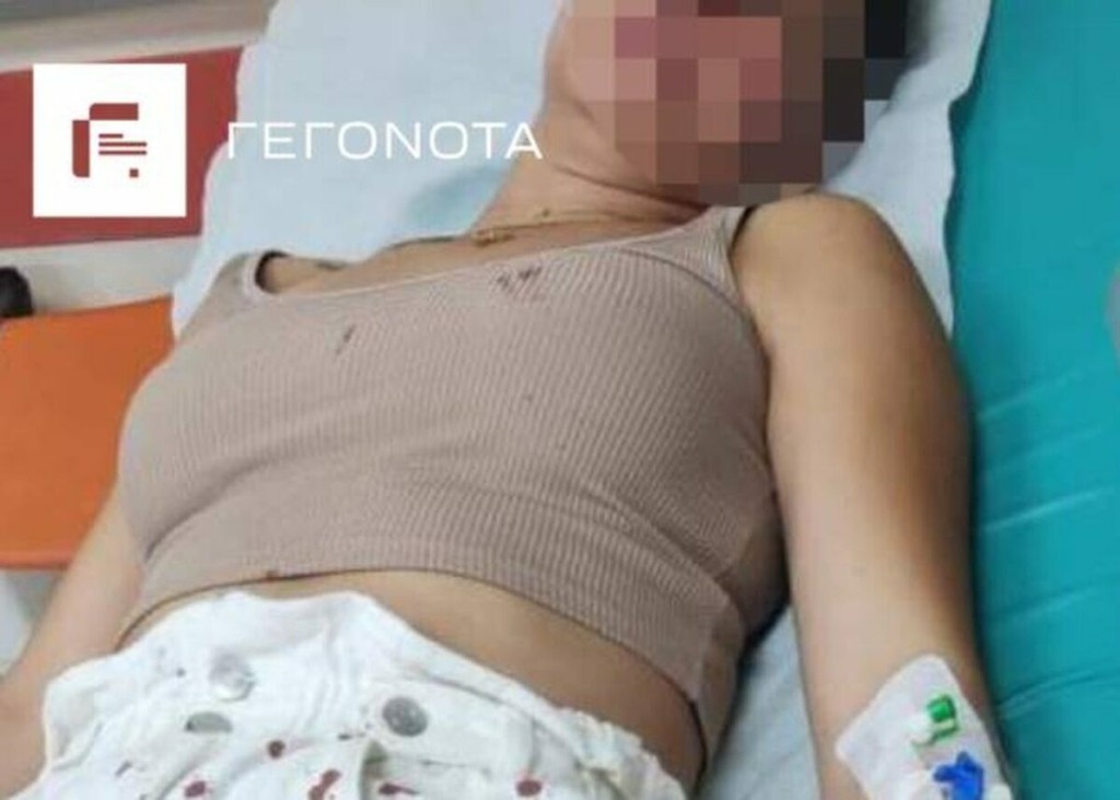Βόλος: Σοκάρουν οι εικόνες της 30χρονης που ξυλοκοπήθηκε από γνωστό αθλητή, πρώην σύζυγό της