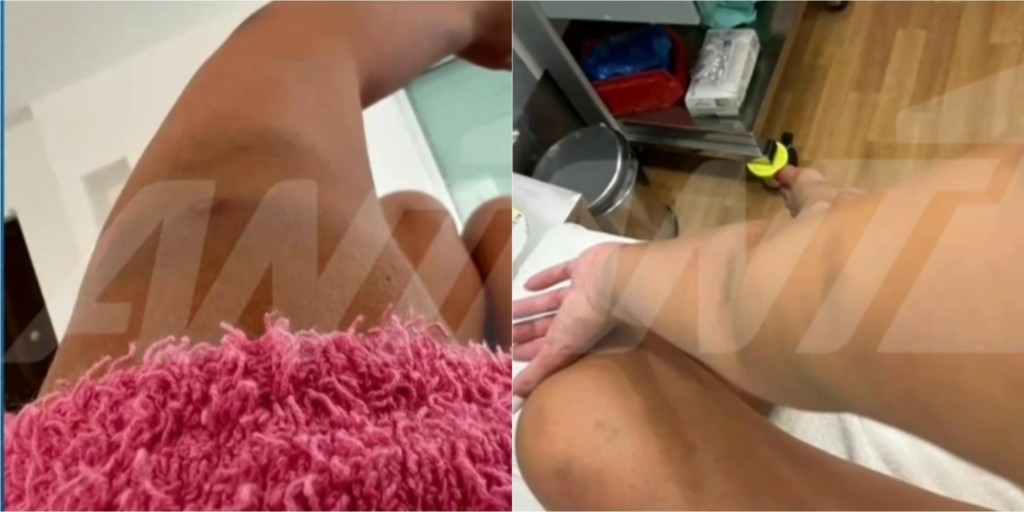 Γνωστός επιχειρηματίας συνελήφθη στη Γλυφάδα για τον ξυλοδαρμό της εγκύου συντρόφου του (vid)