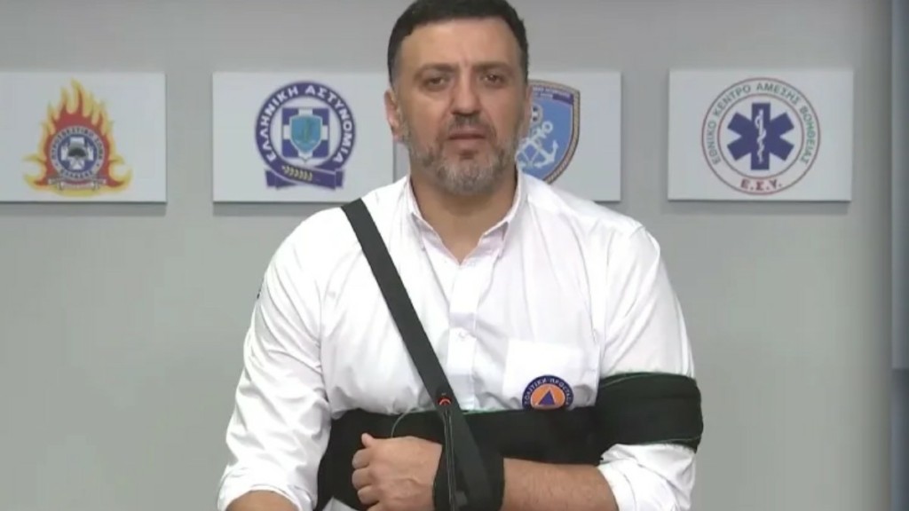 Βασίλης Κικίλιας: Γιατί εμφανίζεται με μπανταρισμένο χέρι 