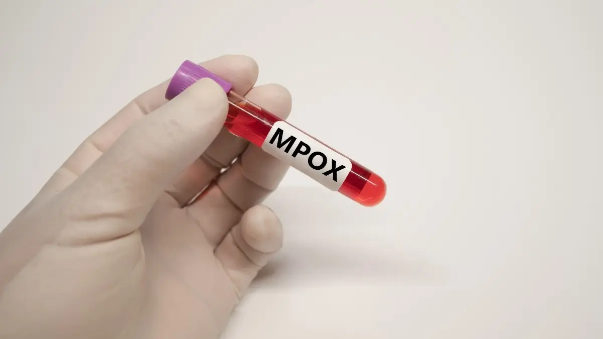Mpox: Στην απομόνωση 33χρονος που νόσησε στην Ιορδανία