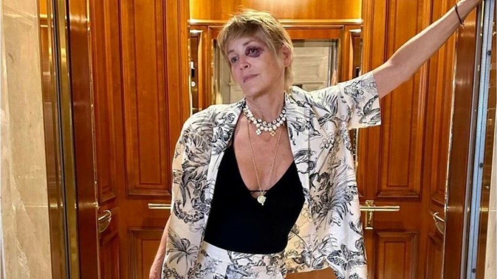 Σάρον Στόουν – Ξεκαθάρισε την αλήθεια πίσω από την είδηση για το μαυρισμένο μάτι της