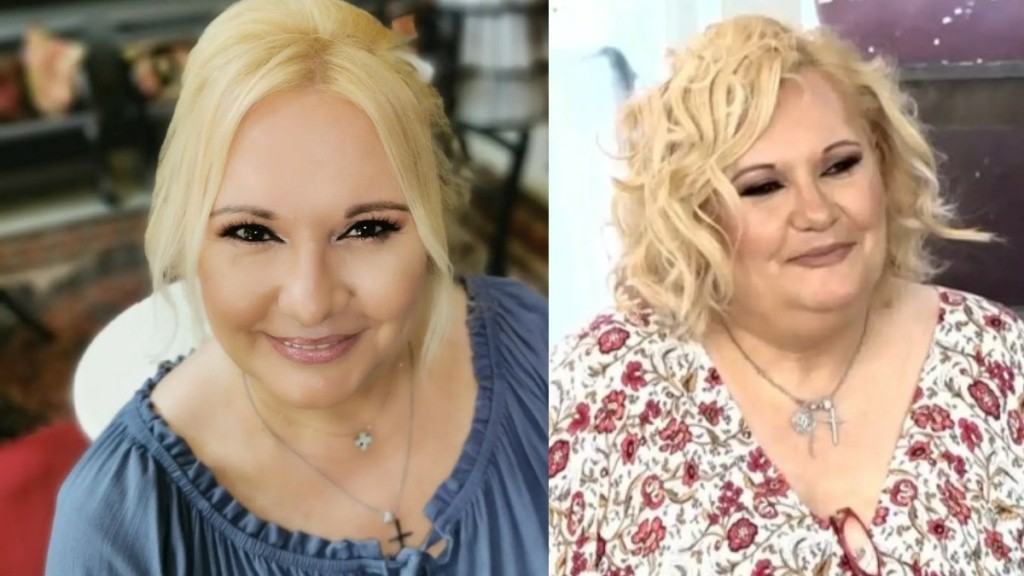Καίτη Φίνου: Η περιπέτεια υγείας μετά τον κορονοϊό – «Έπαθα ωχρά κηλίδα και σάπισαν όλα μου τα δόντια»