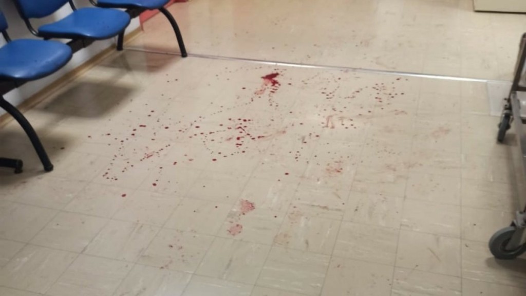 Σπάτα: Ρομά τα έκαναν “γυαλιά καρφιά” στο Κέντρο Υγείας – Χτύπησαν γιατρό και φύλακα που πήγαν να τους σταματήσουν