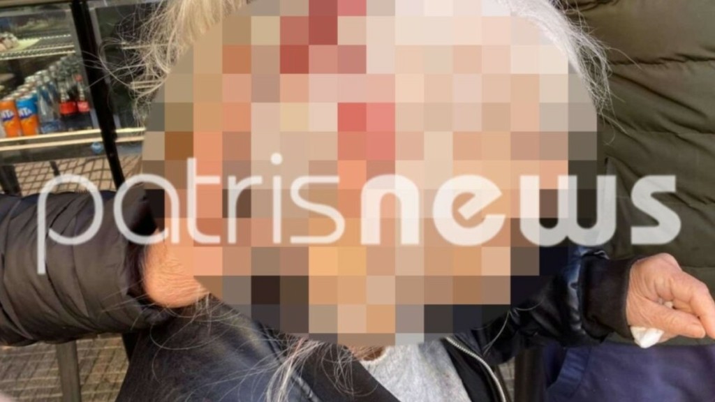 Πύργος: Στο νοσοκομείο 70χρονη μετά από «μάχη» με ληστή