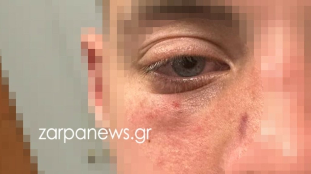 Χανιά: Άνδρας χτύπησε ανήλικους με μπουνιές σε σινεμά γιατί έκαναν φασαρία