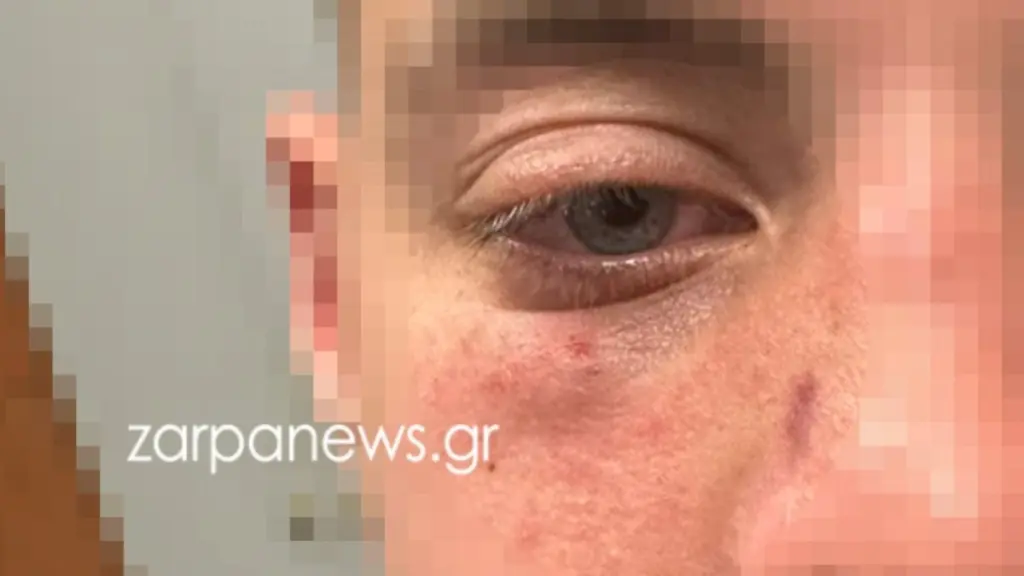 Χανιά: Άνδρας χτύπησε ανήλικους με μπουνιές σε σινεμά γιατί έκαναν φασαρία