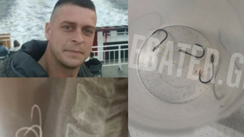 Μαρτυρία στο DEBATER του 38χρονου που έφαγε χταπόδι με αγκίστρια – “Δεν με δέχονταν σε κανένα νοσοκομείο” (Φωτογραφίες)