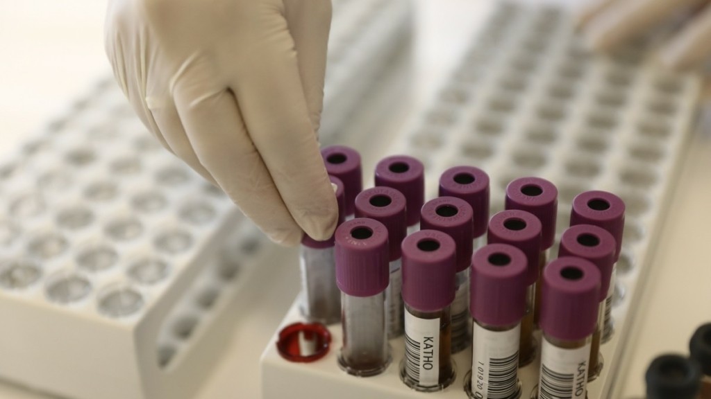 ΕΚΕΑ: Παραιτήθηκε ο Παναγιώτης Κατσίβελας από την θέση του προέδρου