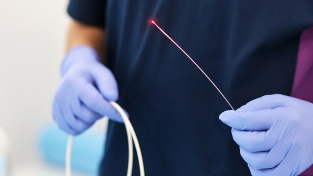 Ενδοαυλική θεραπεία με laser: Αντιμετώπιση κιρσών και φλεβικής ανεπάρκειας