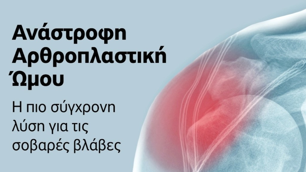 Ανάστροφη Αρθροπλαστική Ώμου: Σύγχρονη λύση για πολύπλοκα προβλήματα