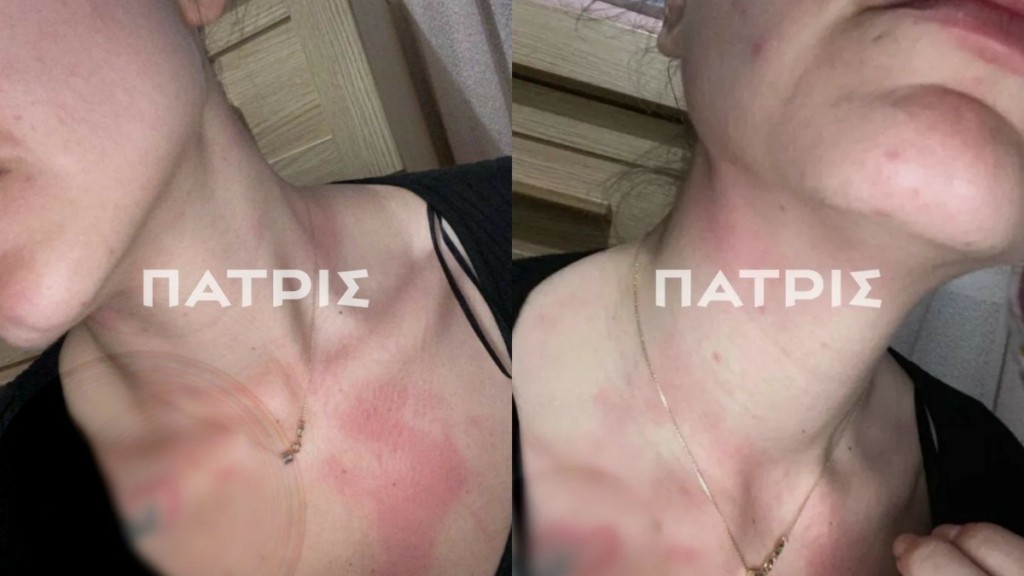 Ηράκλειο: 26χρονη χρειάστηκε να πατήσει το panic button δύο φόρες για να φτάσει η αστυνομία μετά από 30 λεπτά