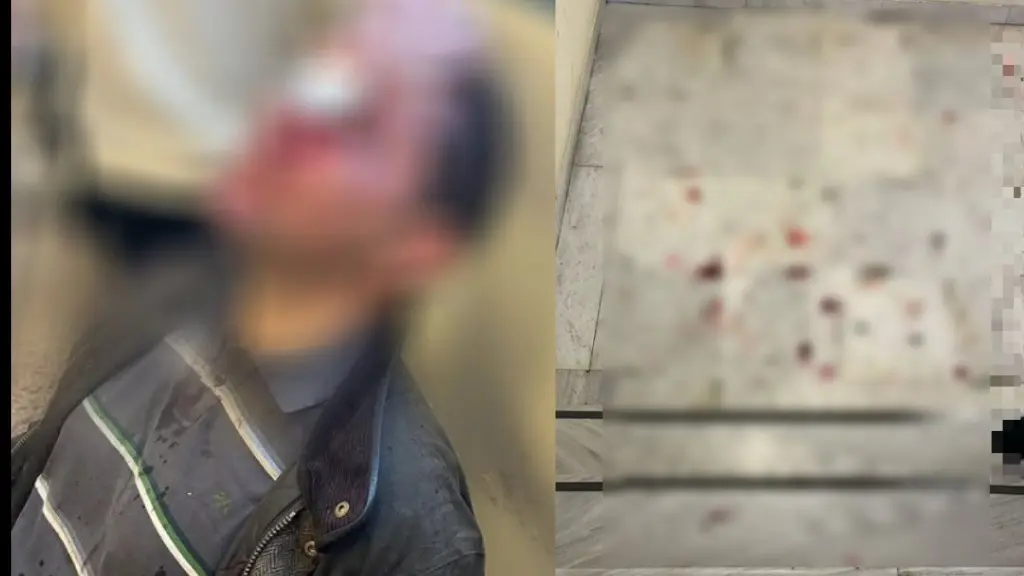 Επίθεση στη Νομική Σχολή: “Τελειώσατε” φώναζαν οι κουκουλοφόροι που επιτέθηκαν με πυροσβεστήρα σε φοιτητή