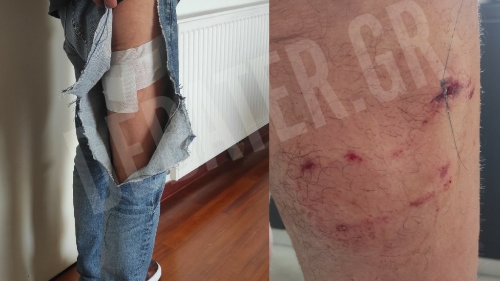 Θεία Τσιτσιπά για την επίθεση στον 71χρονο: “Ήταν δικό μου λάθος, δεν το περίμενα”