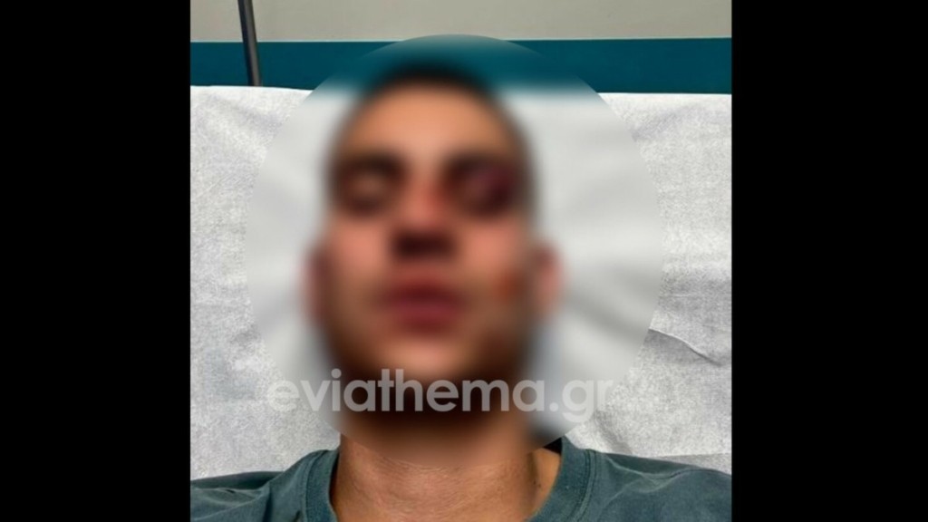 Χαλκίδα: Στο νοσοκομείο 19χρονος με κατάγματα στο κεφάλι – Τον έδειρε 18χρονος επειδή έκανε like στην σύντροφό του