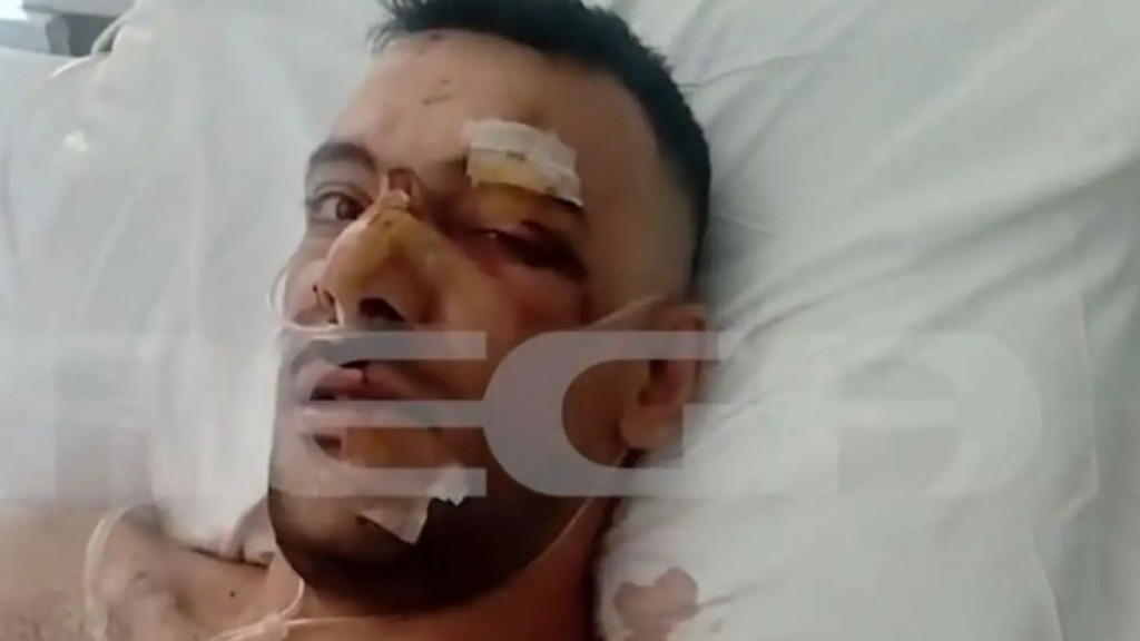 Μυτιλήνη: Αυτός είναι ο 35χρονος που δέχθηκε 18 μαχαιριές- «Του αφαίρεσαν την σπλήνα, έχει τρύπες στον πνεύμονα», λέει ο αδερφός του
