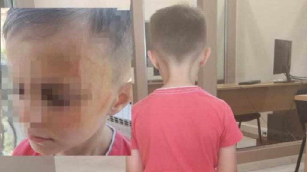 Αγρίνιο: Πεντάχρονος έπεσε θύμα άγριου ξυλοδαρμού από συμμαθητές του – Του ζήτησαν να βγάλει τα ρούχα του