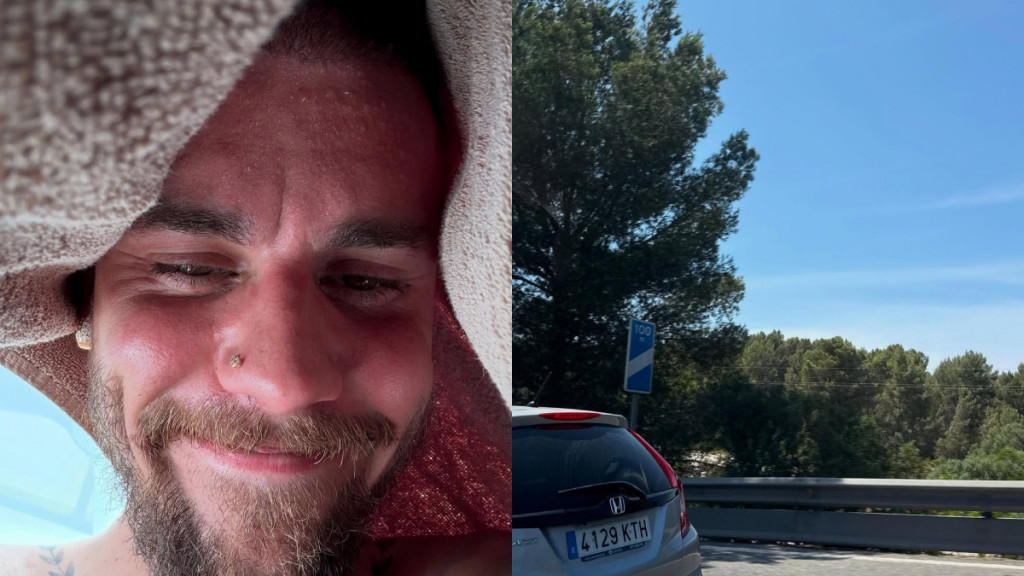 Τζάστιν Μπίμπερ: Κάνει θεραπεία αποτοξίνωσης – Οι φωτογραφίες όπου εμφανίζεται καταπονημένος