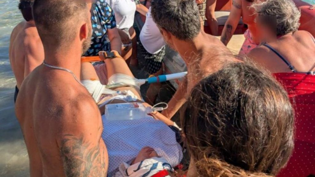 Απίστευτο περιστατικό στη Δονούσα: Ομπρέλα παρασύρθηκε από τον αέρα και καρφώθηκε στον μηρό λουόμενης