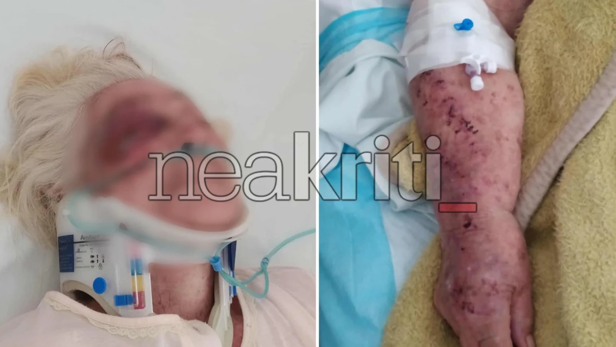 Ηράκλειο: Ηλικιωμένη παρασύρθηκε από ανήλικο οδηγό μηχανής – Σοκάρουν οι εικόνες (Εικόνα)