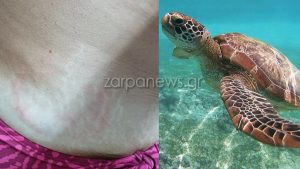 Χανιά: Νέο περιστατικό δαγκώματος από χελώνα σε παραλία (Εικόνα)