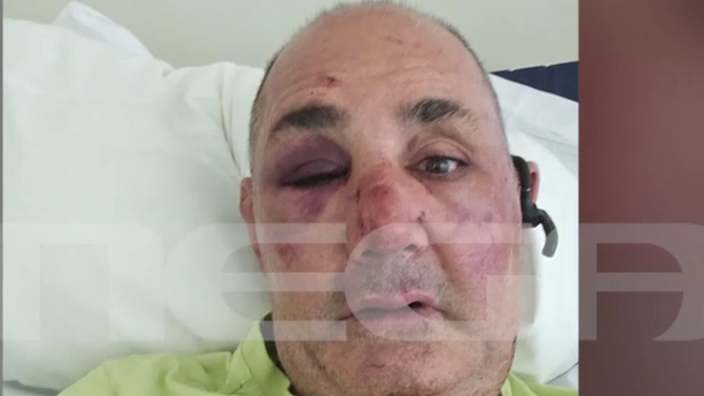 Ρόδος: Ληστές ξυλοκόπησαν χρυσοχόο και άρπαξαν κοσμήματα – Πίστευα ότι θα πεθάνω» (Βίντεο)