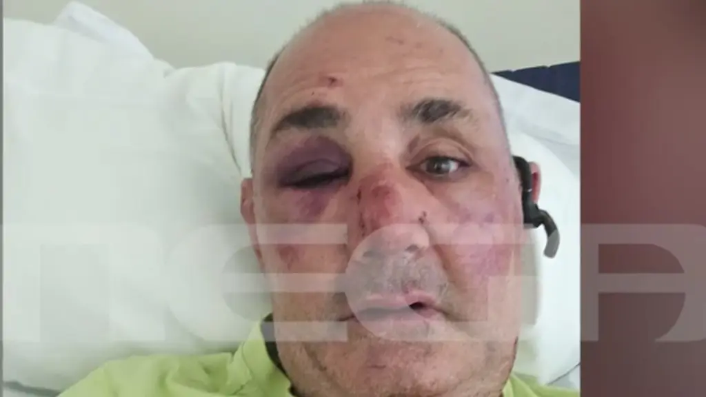 Ρόδος: Ληστές ξυλοκόπησαν χρυσοχόο και άρπαξαν κοσμήματα – Πίστευα ότι θα πεθάνω» (Βίντεο)