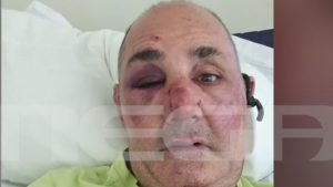 Ρόδος: Ληστές ξυλοκόπησαν χρυσοχόο και άρπαξαν κοσμήματα – Πίστευα ότι θα πεθάνω» (Βίντεο)