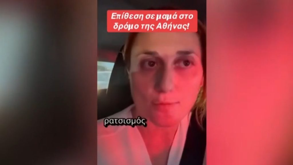 Αδιανόητο περιστατικό: Διανομέας “με έβρισε και με έφτυσε στο πρόσωπο” – Τι καταγγέλλει εκπαιδευτικός