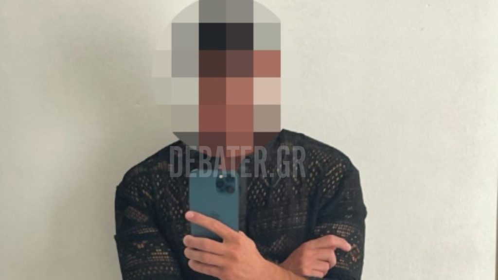 “Μου είπε και λίγα σου έκανα” – Σοκάρει η μαρτυρία της 43χρονης που έπεσε θύμα ξυλοδαρμού από πλαστικό χειρουργό στη μέση του δρόμου