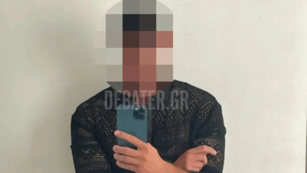 “Μου είπε και λίγα σου έκανα”: Σοκάρει η 43χρονη που ξυλοκοπήθηκε στη μέση του δρόμου από τον επιχειρηματία και “πλαστικό χειρουργό”