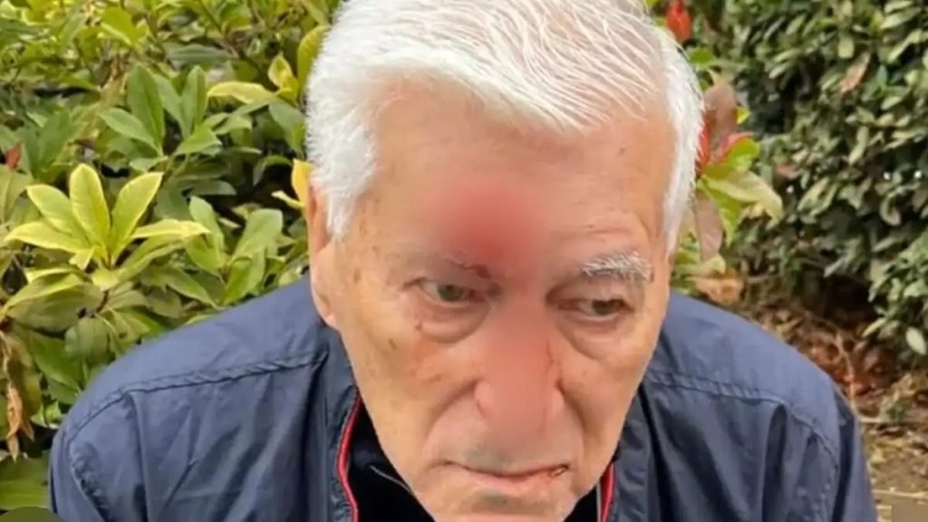 Θεσσαλονίκη: 82χρονος ξυλοκοπήθηκε από γιατρό – «Μου είπε ότι του χτύπησα το αμάξι» (Βίντεο)