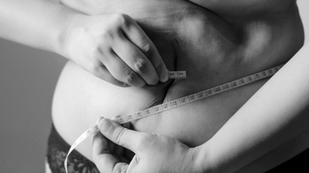 Παχυσαρκία: Ποιοι δικαιούνται τα δωρεάν φάρμακα – Τα κριτήρια και η διαδικασία