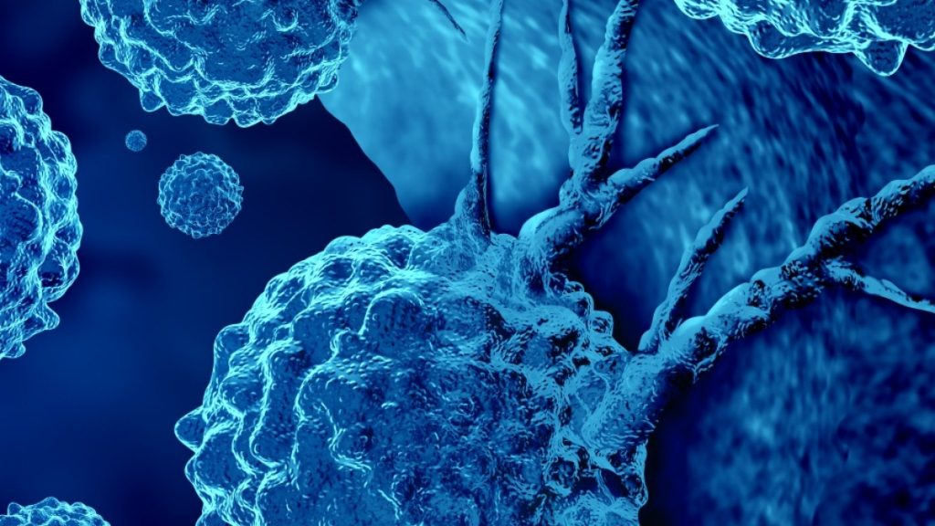 Μεταστατικός καρκίνος: Όταν δεν εντοπίζεται η αρχική εστία