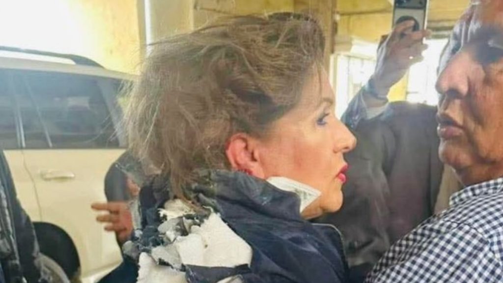 Ονδούρα: Εκτόξευσαν εκρηκτικό μηχανισμό στο κεφάλι βουλευτή – Σοκαριστικό βίντεο