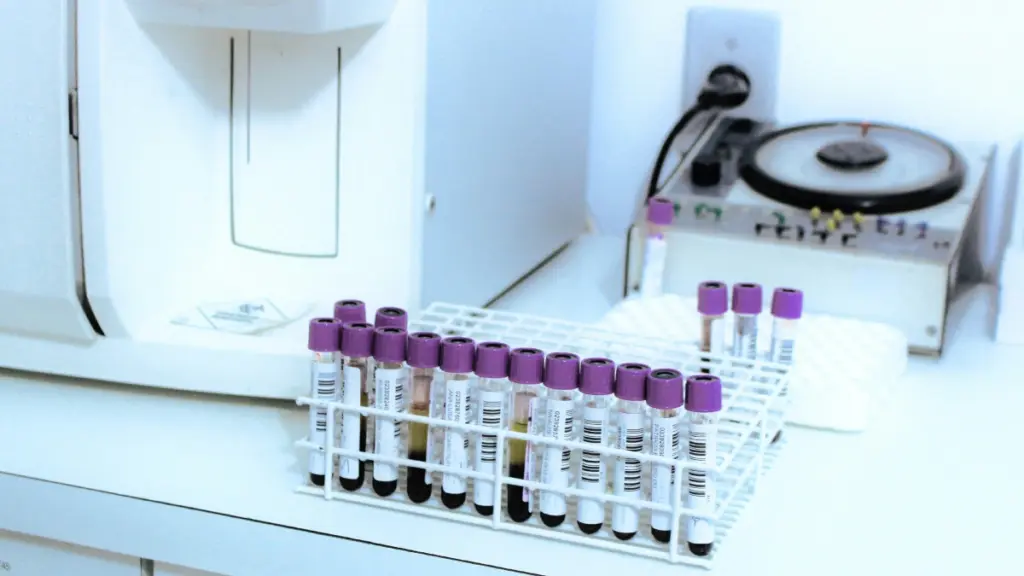 Νόσος του Crohn: Μια απλή εξέταση αίματος μπορεί να την προβλέψει χρόνια πριν από την εμφάνιση των συμπτωμάτων